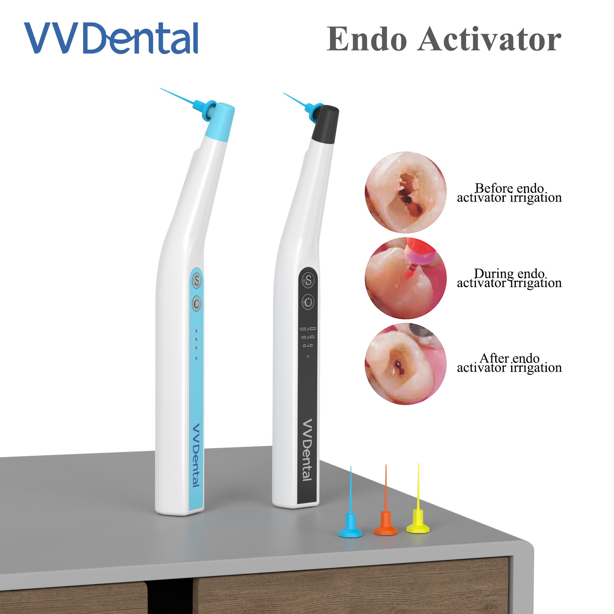 Tandheelkunde Sonische Irrigator Tips Endo Activator Met Led Licht Voor Tandheelkundig Instrument Wortelkanaal Sonische Irrigator Endodontische Gereedschappen