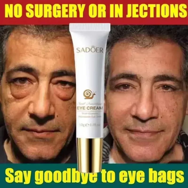 Instant Oogcrème Voor Anti Aging Donkere Kringen Zakken Wallen Geweldig Onder De Ogen Huidverstrakking Eye Lift Vetkorrels Remover Zorg