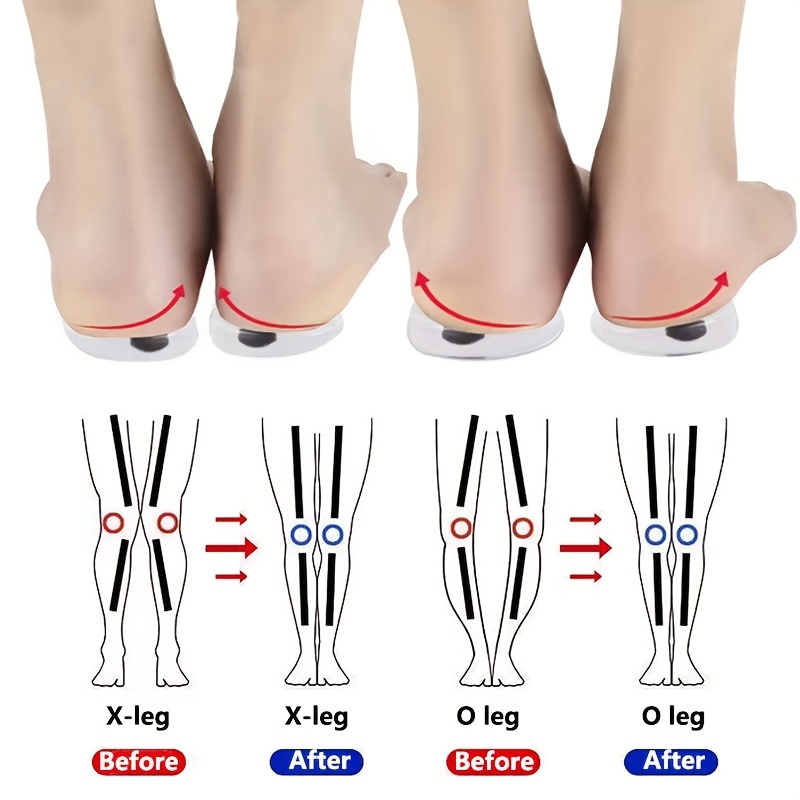 1 par de plantillas de gel de silicona para pies con forma de X/O con almohadilla magnética para el talón, para hombres y mujeres, inserto para el cuidado de los pies para mayor comodidad
