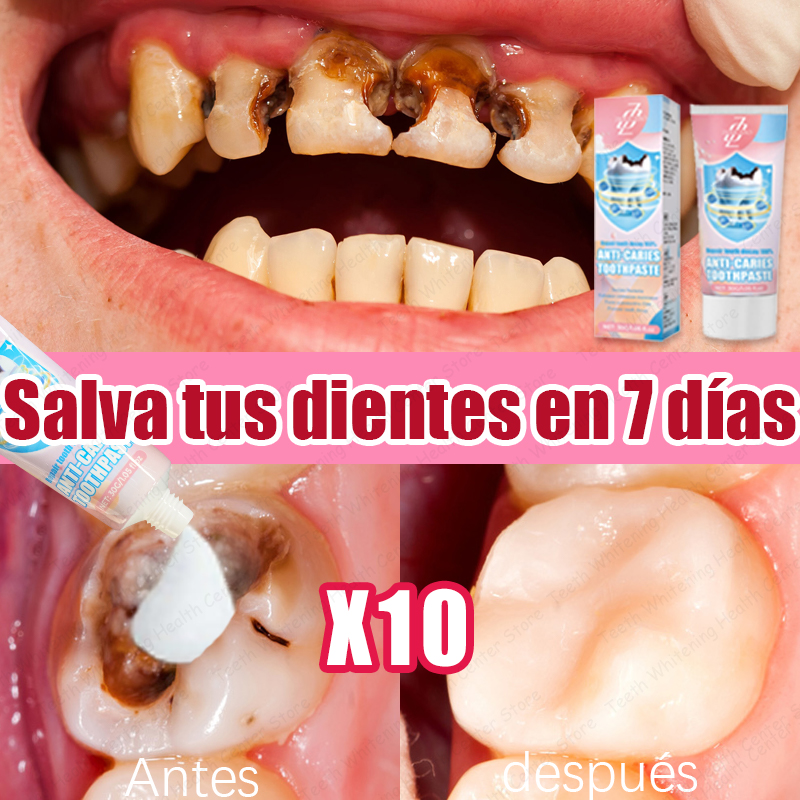 99% DE PERSONAS ʀᴇᴄᴏᴍᴘʀᴀ, Vᴇɴᴛᴀ ᴄᴀʟɪᴇɴᴛᴇ ᴘᴀʀᴀ ʀᴇᴘᴀʀᴀᴄɪᴏ́ɴ ᴅᴇ ᴄᴀʀɪᴇs ᴅᴇɴᴛᴀʟᴇs