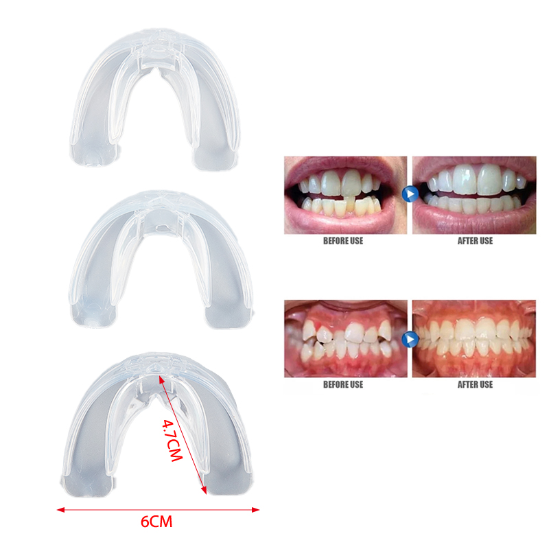 Nha Khoa Chỉnh Hình Răng Corrector Ốp Lưng Dẻo Silicon Giữ Thẳng Dụng Cụ Răng Khoác Áo Cho Người Lớn Chăm Sóc Răng Dụng Cụ 3 Giai Đoạn