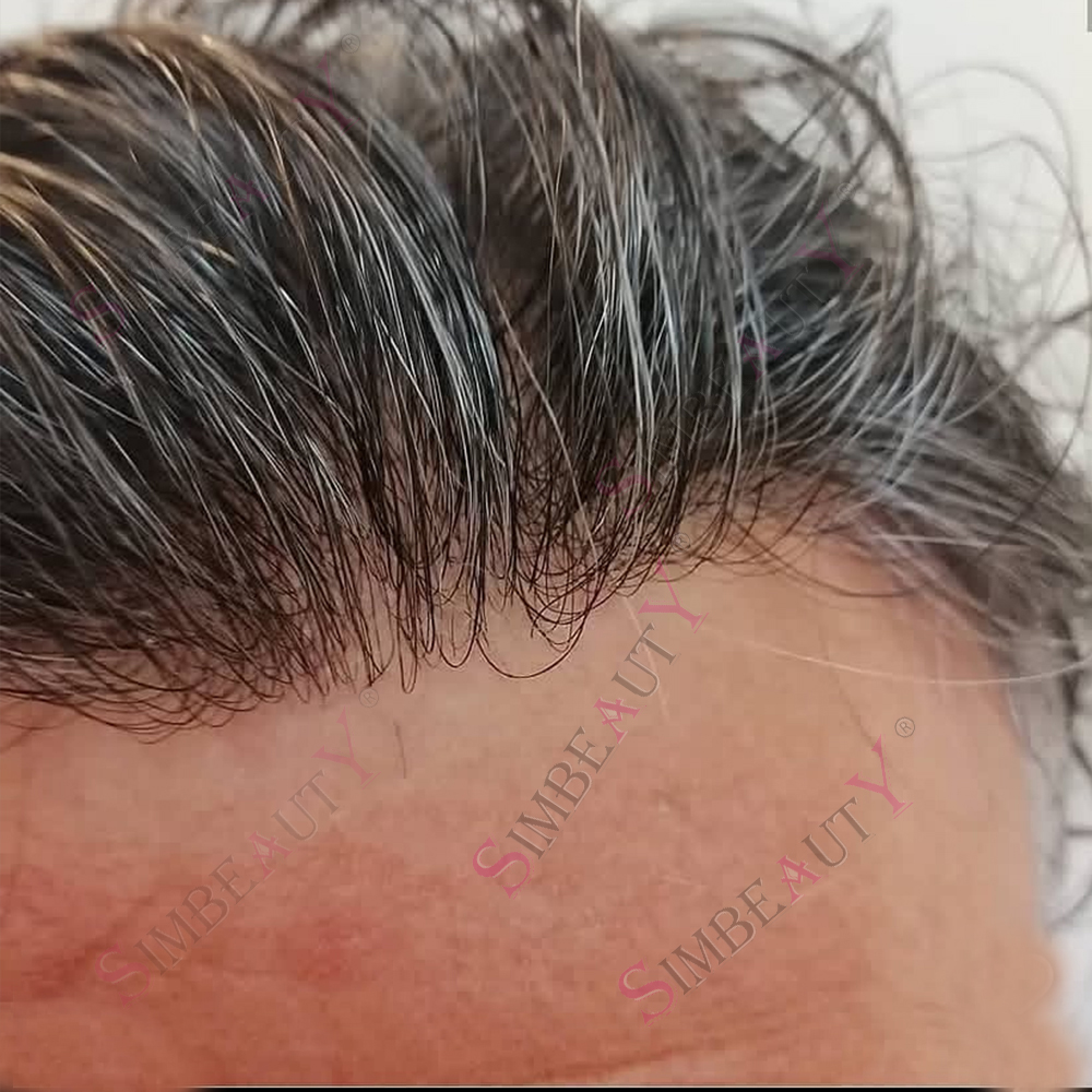 Prótesis Capilar Masculina Invisible con Línea de Cabello Natural Realista, 0.04mm-0.05mm, 80%-100% de Densidad, Piel Súper Delgada, Vloop 540 #   Prótesis de Cabello Humano