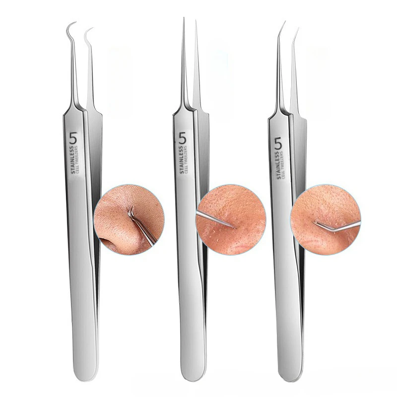 Alemán Ultrafino No. Pinzas con Clip para espinillas y espinillas, 5 celdas, belleza, cara, salón de salud, producto especial para eliminar espinillas, herramienta de aguja para acné