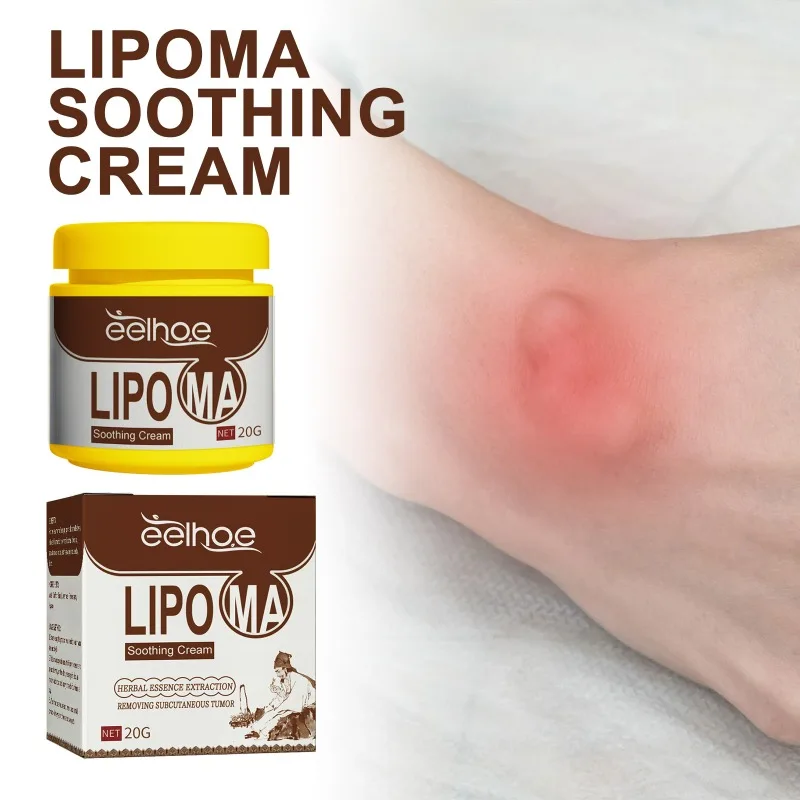 Крем Lipoma, средство для удаления ложек под кожу, лечение, жидкость для лечения, набухание кожи, целлюлитный Fibroma, пластырь для массы жира