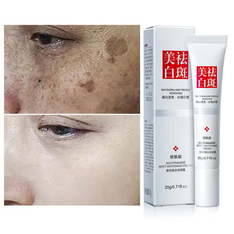 Effective Whiten Freckle Cream Remove Melasma Dark Spot  Anti-pigmentation Brighten Face Improve Dullness Cream Skin Care Cream