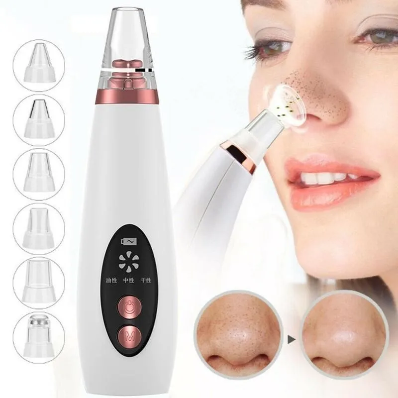 Aspirador de Poros Facial con Carga USB, Removedor de Puntos Negros y Acné, Herramienta de Limpieza Profunda para el Cuidado de la Piel con Limpiador de Puntos Negros para Eliminar Granos
