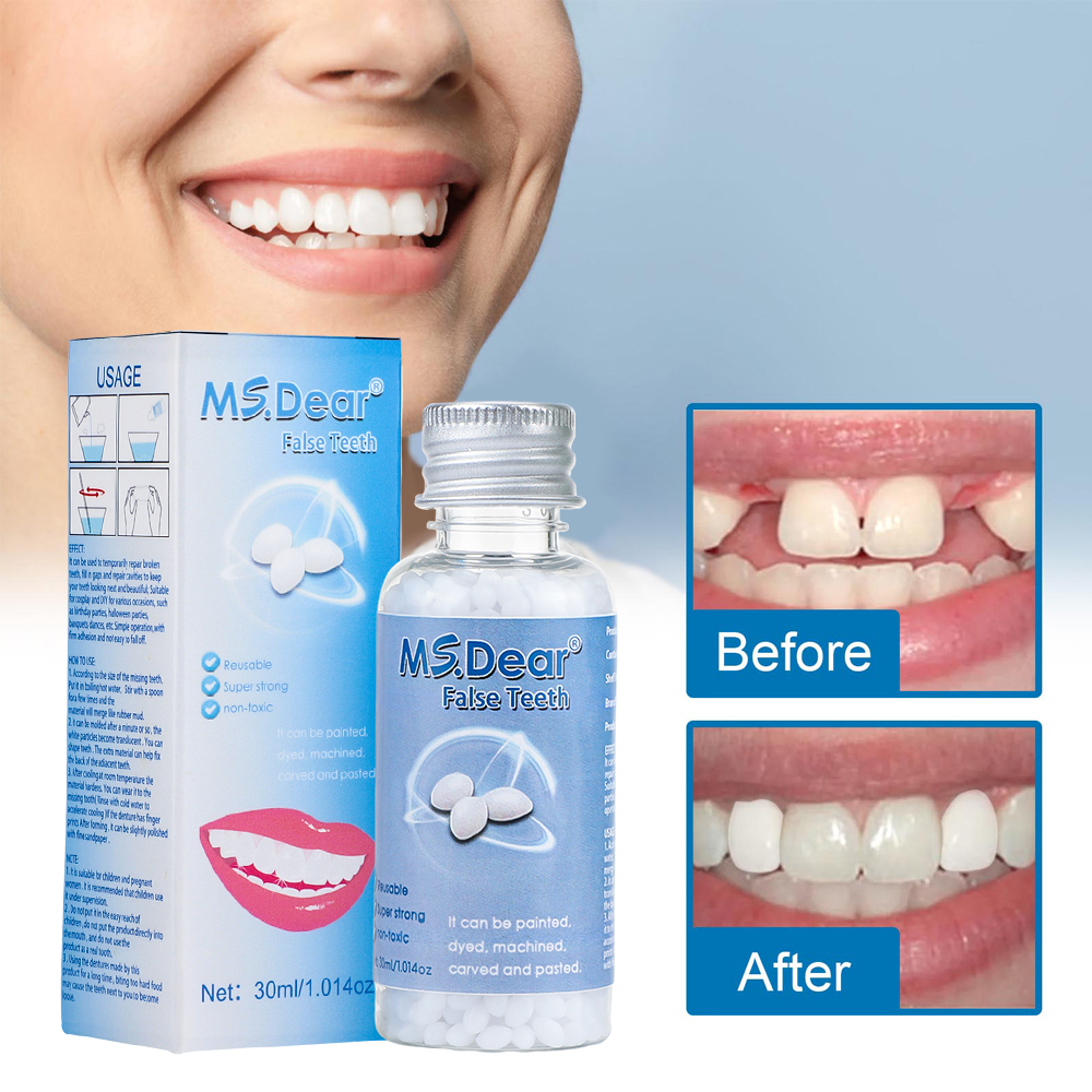 30ml Moldable ฟันปลอมฟันปลอมกาวทํา Veneers พลาสติกยางชั่วคราวฟันช่องว่างหักซ่อมทันตกรรมเครื่องมือความงาม
