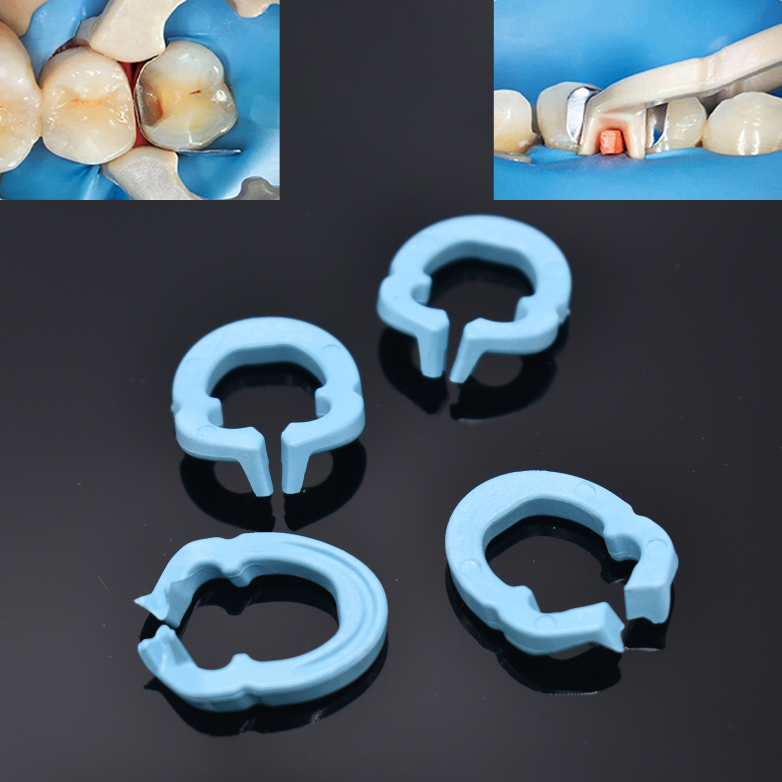 4 Pezzi Anello di Fissaggio per Resina Dentale, Anello Separatore, Supporto per Matrici Metalliche Sezionate Sagomate, Morsetto Fissatore per Matrici, Autoclavabile