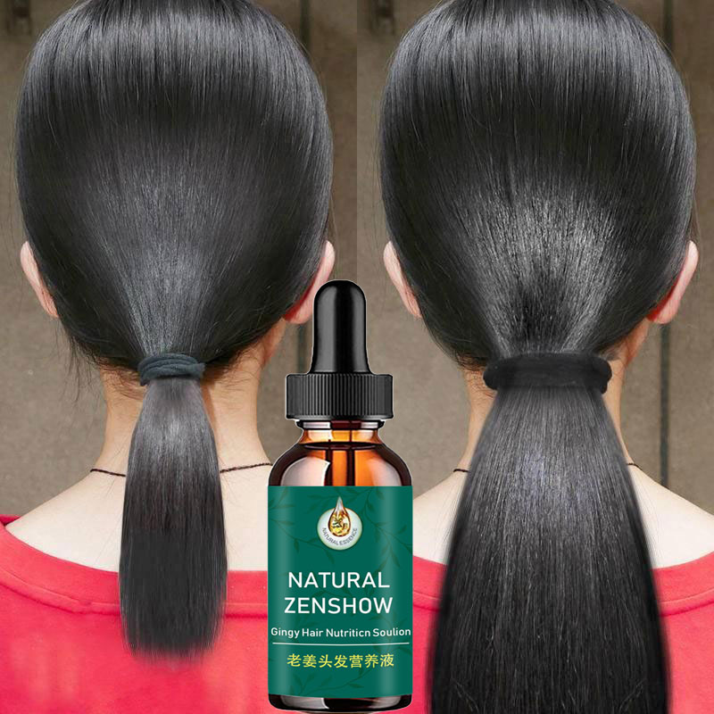 Gừng Mọc Tóc Tinh Dầu Tóc Thảo Dược Dưỡng Tóc Phục Hồi Tóc Nang Kích Thích Mọc Tóc
